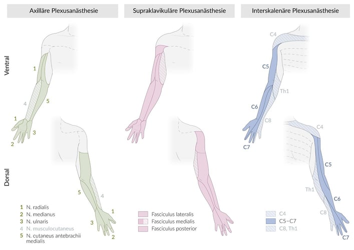 Blog Regionalanästhesie AMBOSS