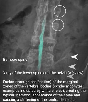 An example of image overlays that can be found in the AMBOSS medical images. This can be studied during clinical clerkships.