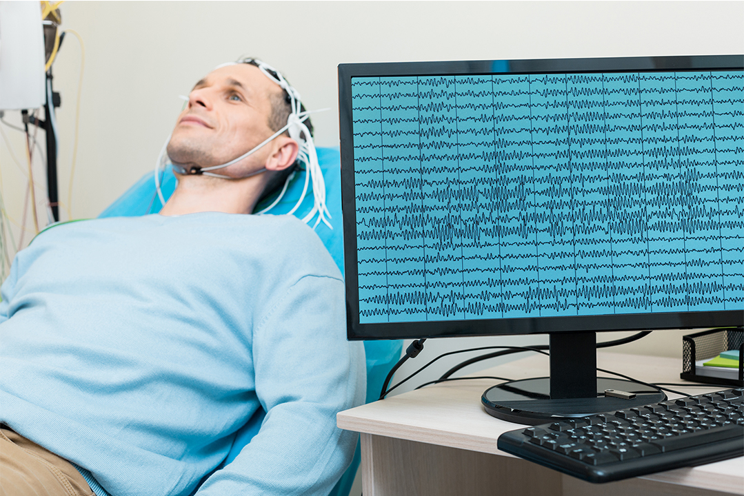 AMBOSS Medizin Blog Epilepsie Diagnose ILAE Klassifikation