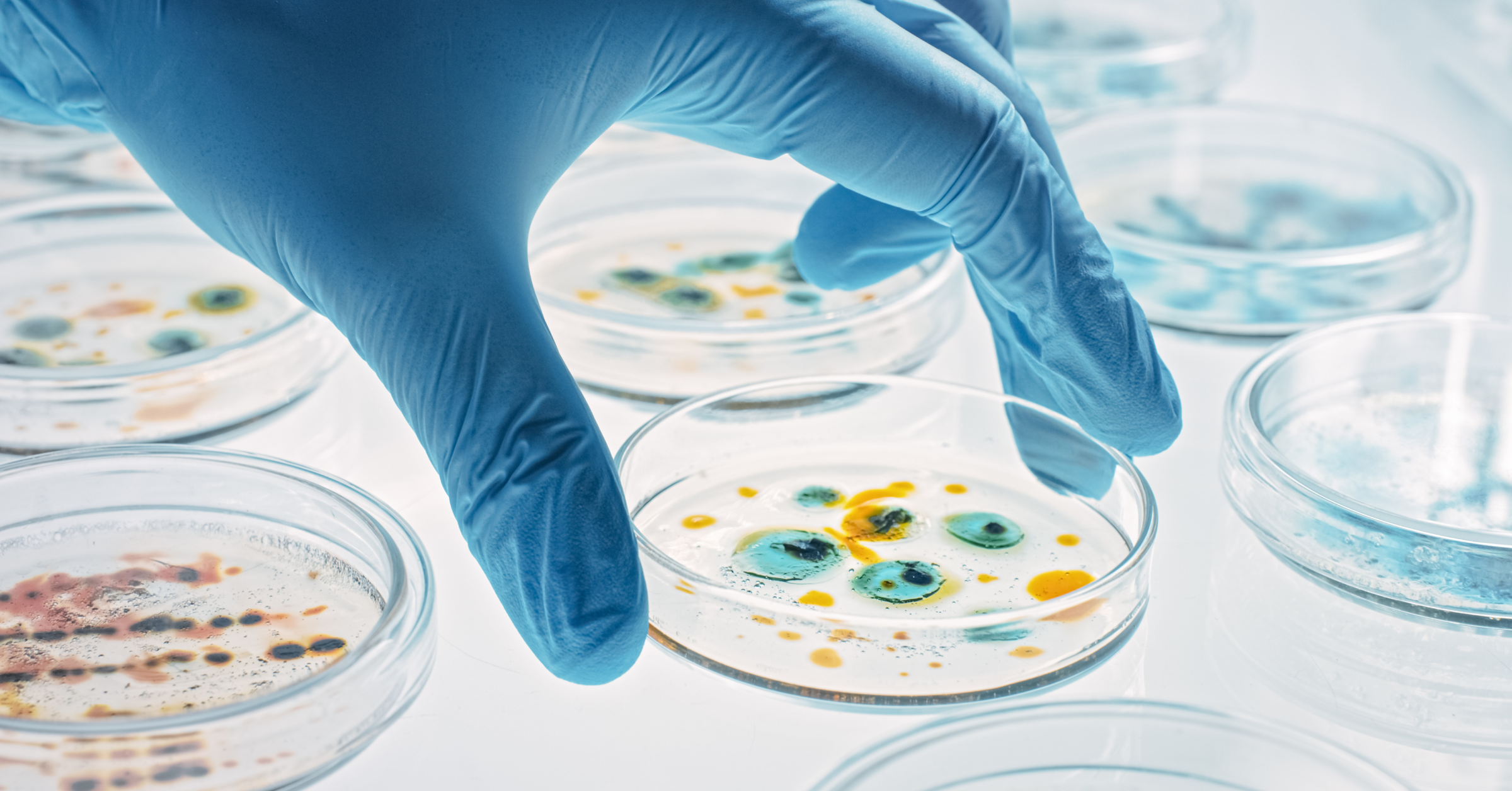 Neue Wirkstoffe im Kampf gegen Antibiotikaresistenzen. Eine Hand hält eine Petrischale mit Bakterienkulturen. Neue Antibiotika im AMBOSS-Blog.