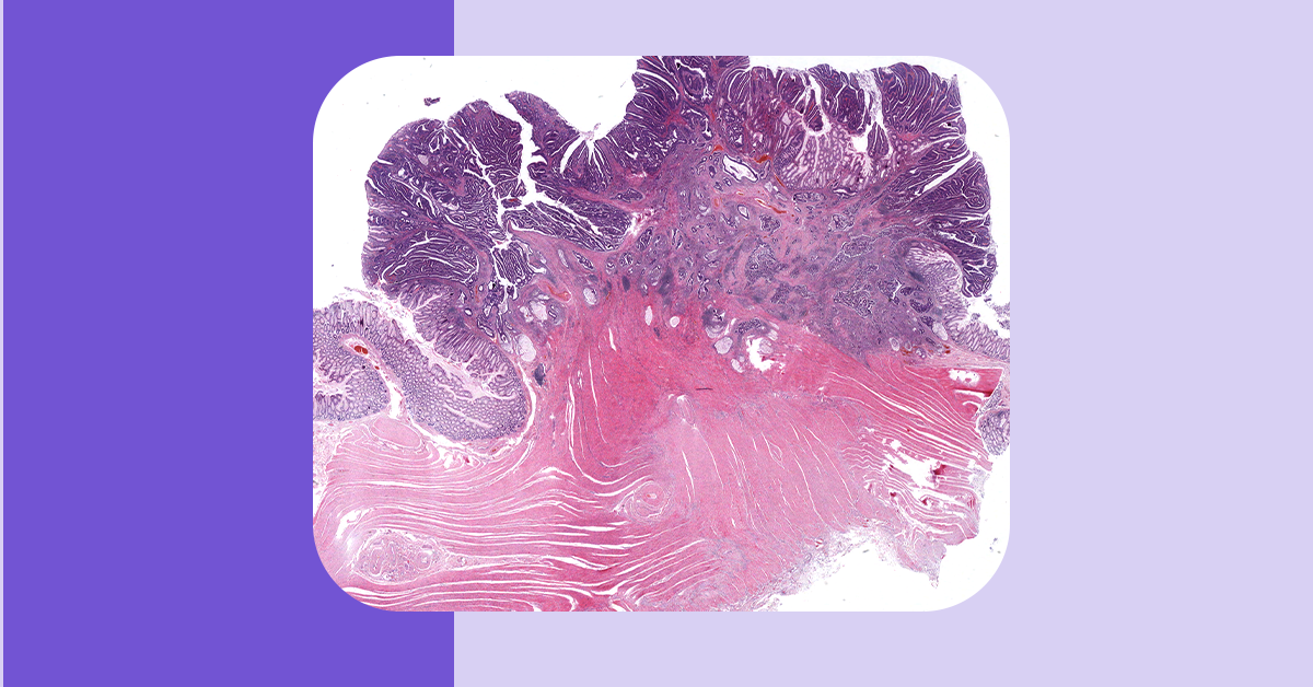 Histology image related to Step 1 study 