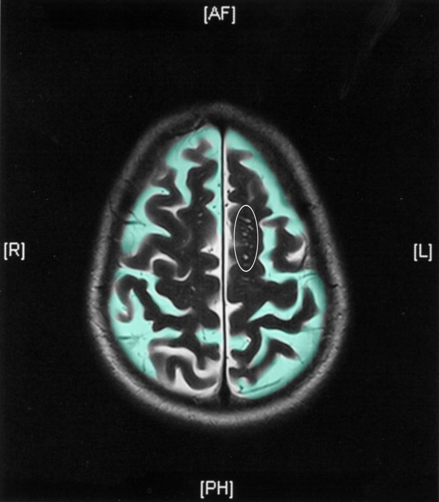   Learn to interpret results with real clinical data. Toggle-on overlays and illustrations to point out exactly what you need to see, from X-rays to EKGs.  