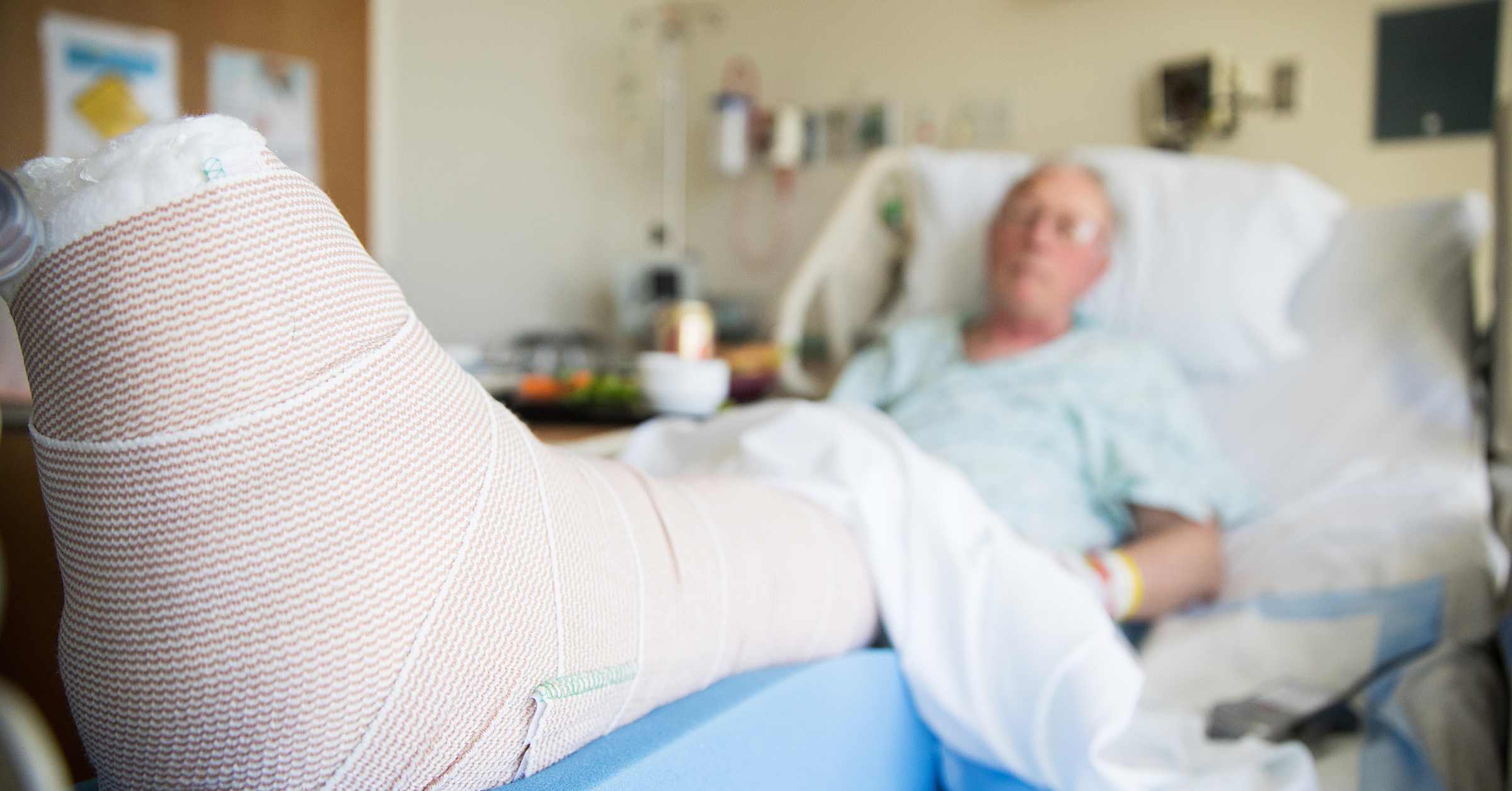 Eine geriatrische Patientin liegt mit einem eingegipsten Bein in einem Krankenhausbett. Multimorbidität in der Alterstraumatologie im AMBOSS-Blog.